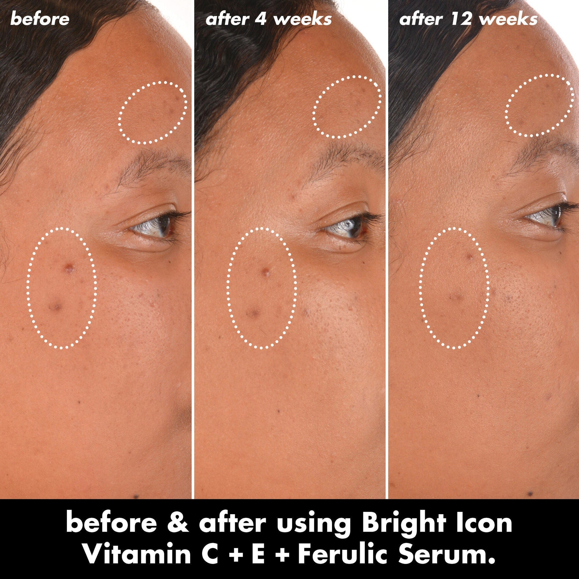 bright-icon-vitamin-c-e-ferulic-serum-o8 0226_EDU_BrightIconVitC_BA_Chanel_TRIPTYCH_c58f2fc8-209d-414f-9ba3-666a07a94887.jpg