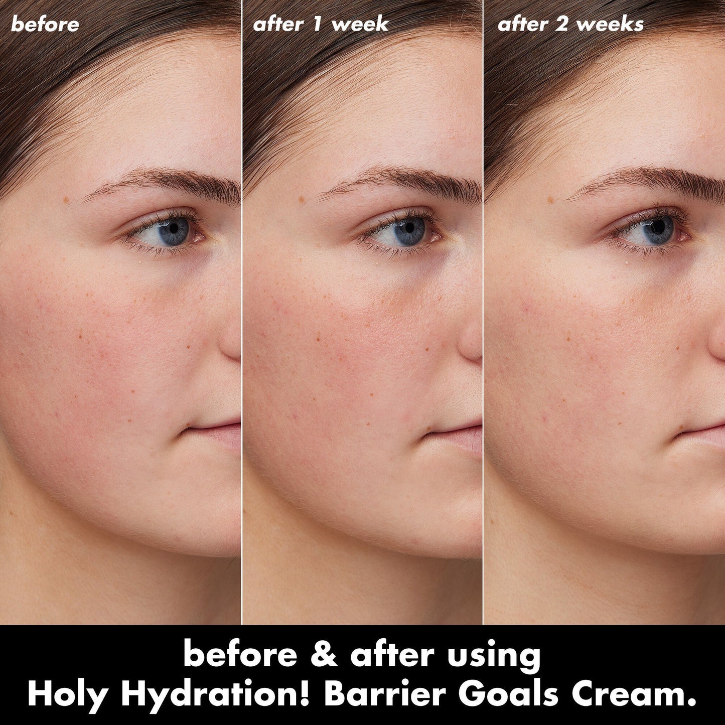 holy-hydration-barrier-goals-cream-i1 0226_EDU_HHBarrierGoalsCream_B_A_Zoe_TRYPTICH_710f5249-3a6b-41fd-89e4-817294dd9258.jpg