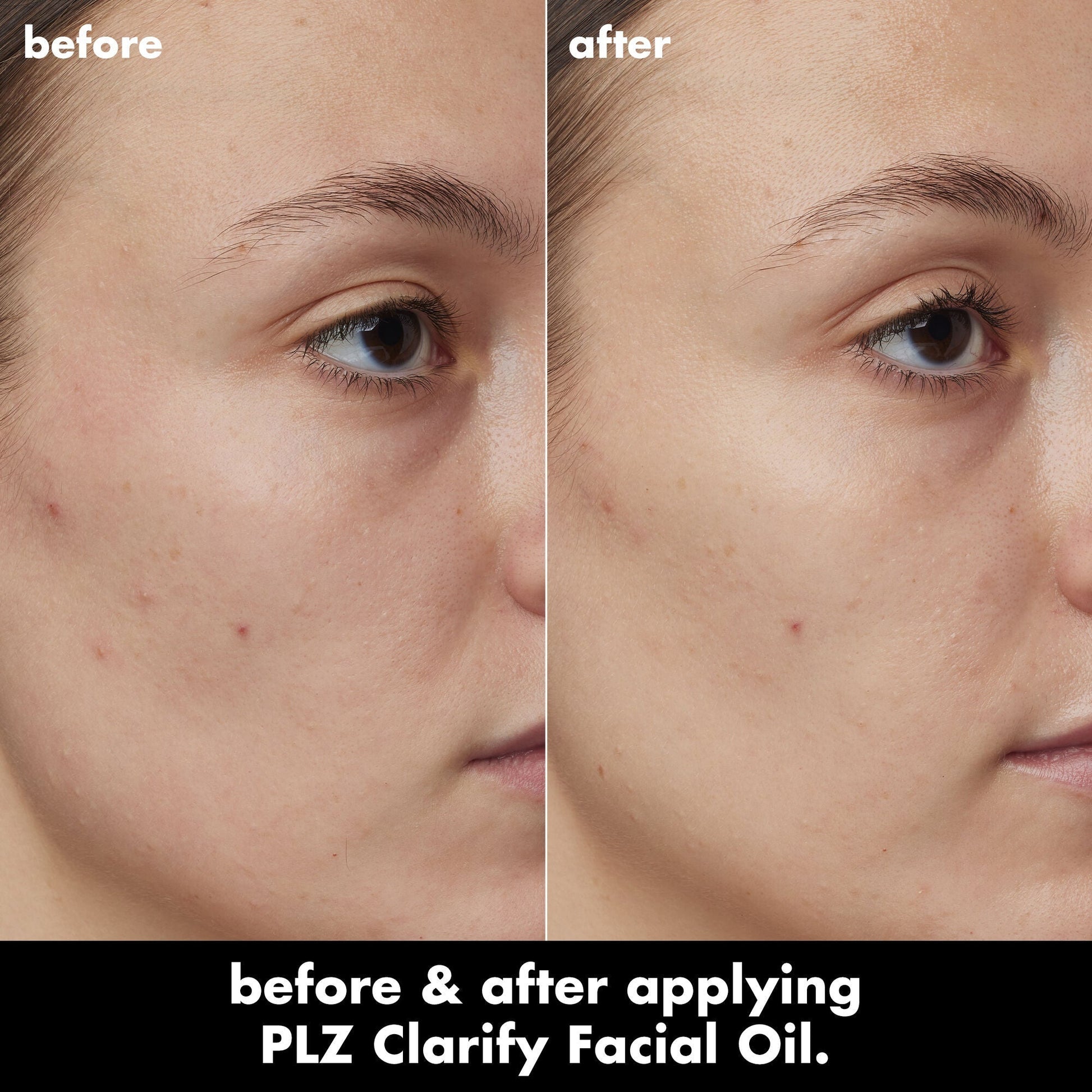 plz-clarify-facial-oil-y0 0326_EDU_PlzClarify_BA_Kelly.jpg