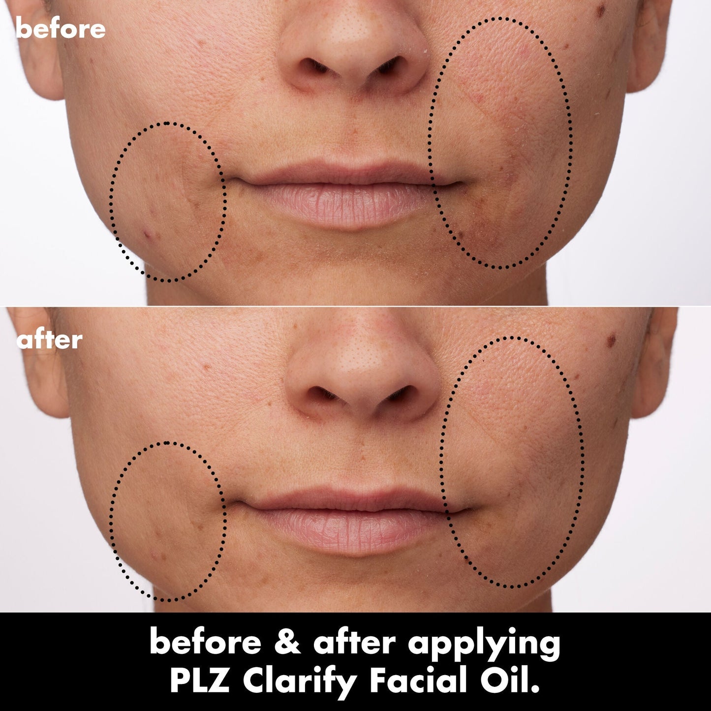 plz-clarify-facial-oil-y0 0326_EDU_PlzClarify_BA_Paula.jpg