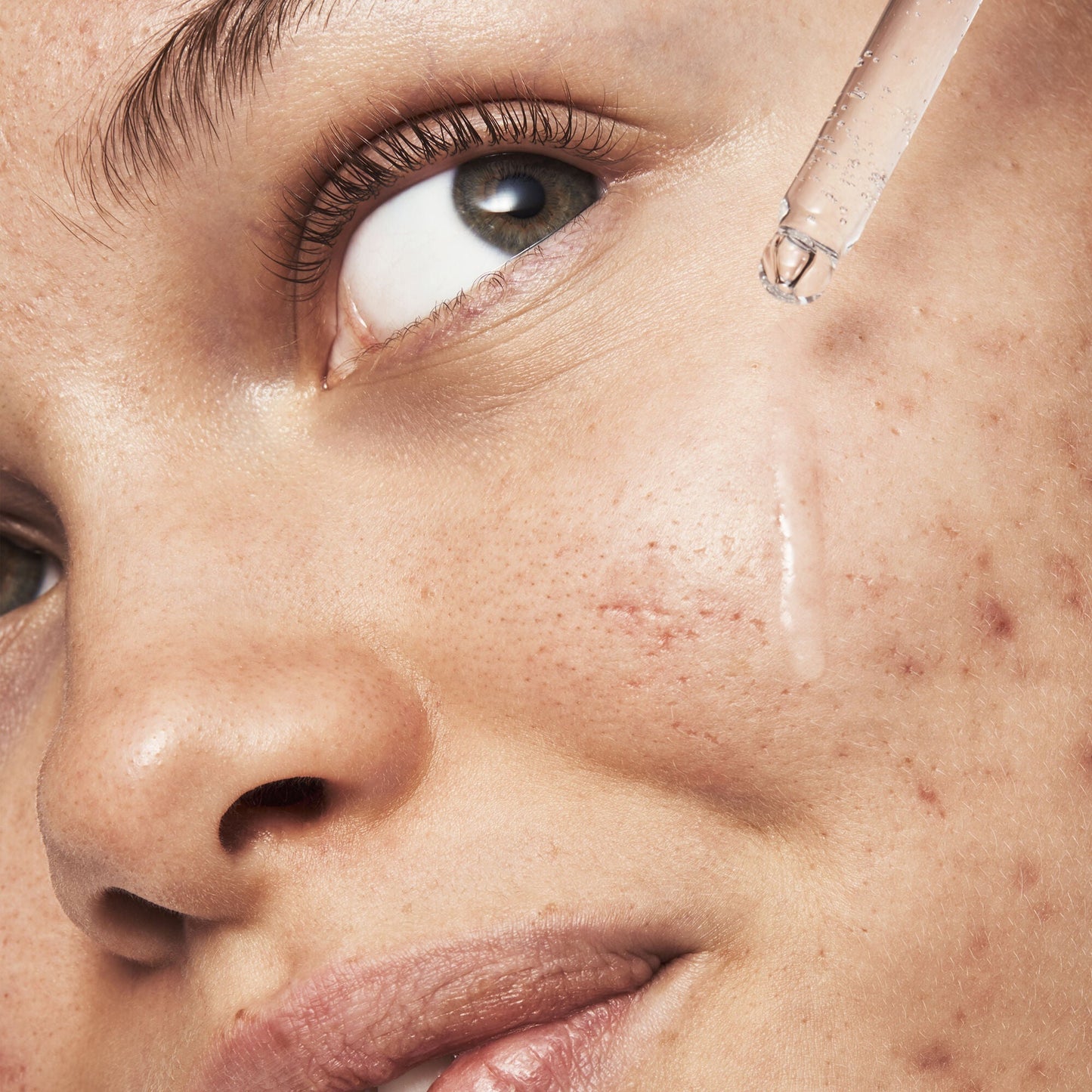 blemish-breakthrough-triple-acid-resurfacing-serum-t7 121321_Marley-Acne-Regimen_0254_FINAL_IGF.jpg