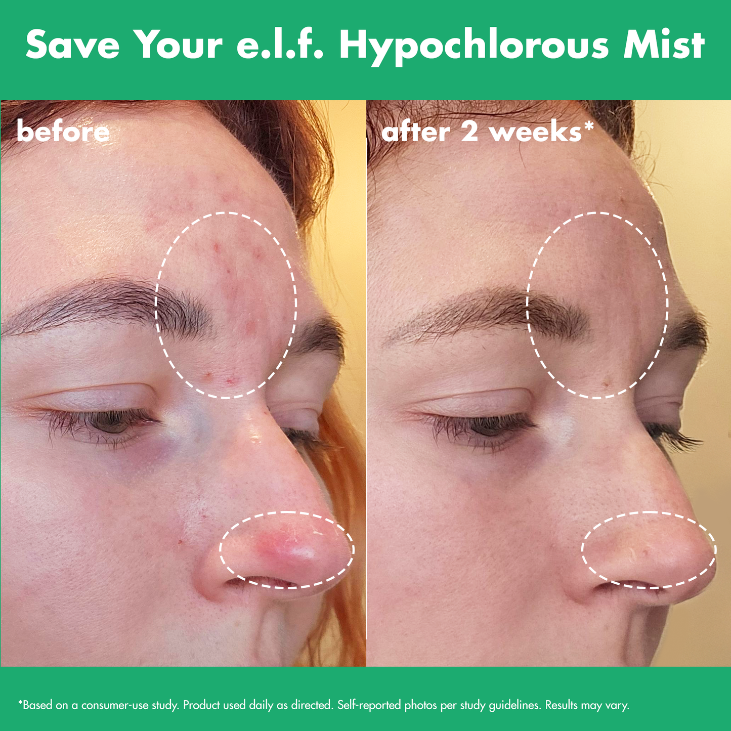 save-your-e-l-f-hypochlorous-mist-t2 FA26_EDUCATION_SAVEYOURELF_USAGE_BA1_WITHOUT_CLAIMS.png